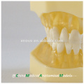 China Medical Anatomical Model Transparent Soft Gingiva Dental Jaw Model 13013